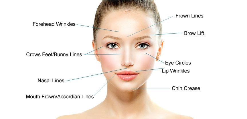 What causes lines and wrinkles?​