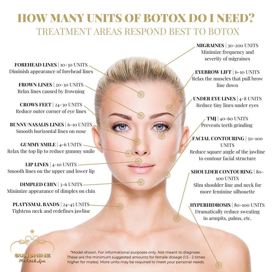Recommended Botox injection dosage for our clients in Kitchener Waterloo area.