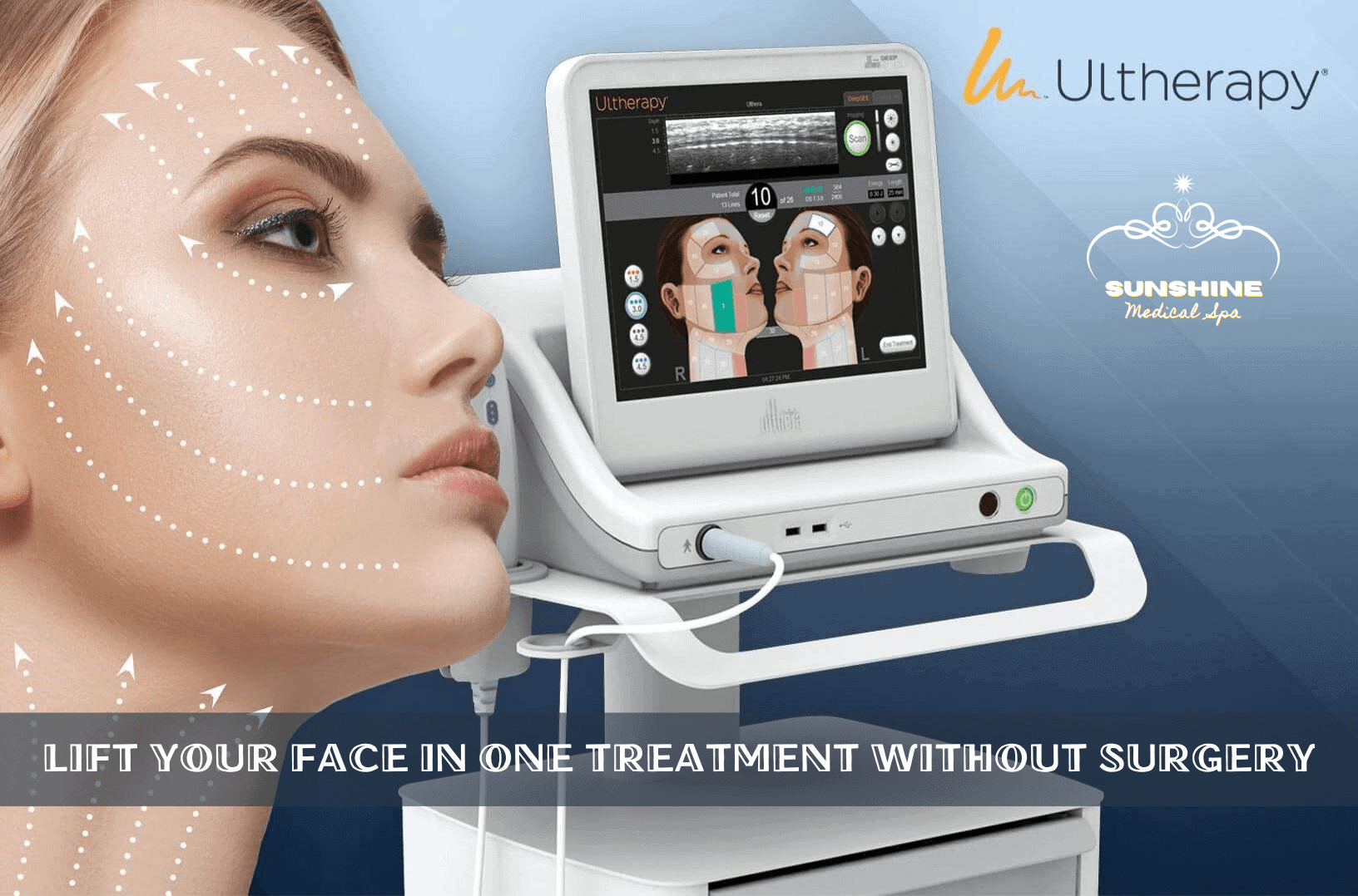 We provide 10+ skin tightening and face lift treatments in Waterloo Kitchener area. Ultherapy is our top choice, which can lift your face in only one treatment with results last for years.
