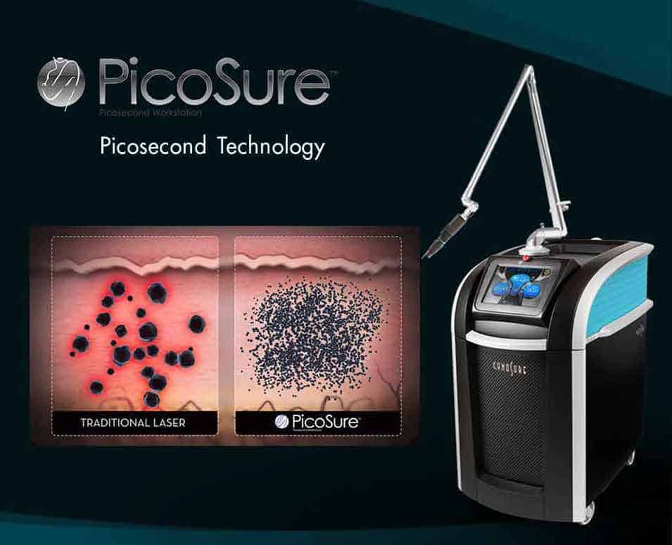 We offer PicoSure in Kitchener Waterloo area for skin rejuvenation
