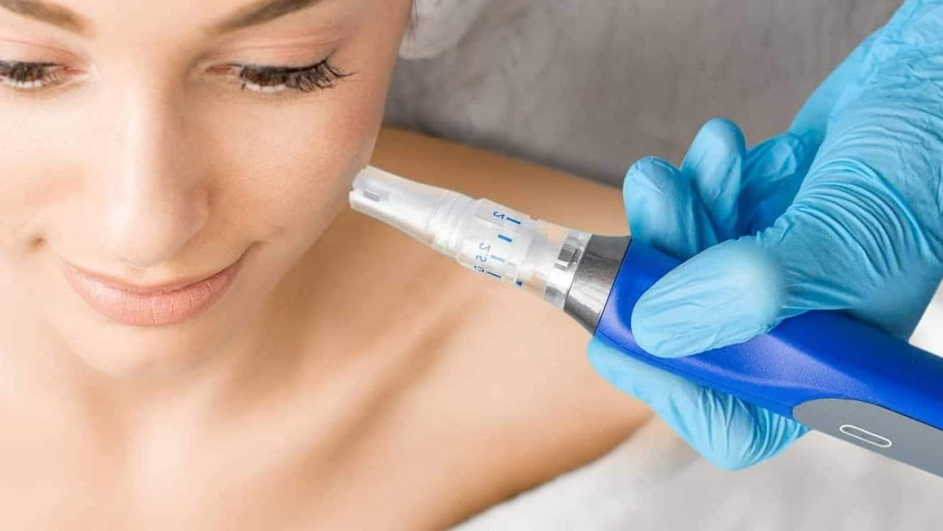 We are a leading Kitchener-Waterloo microneedling clinic and offer SkinPen micro-needling