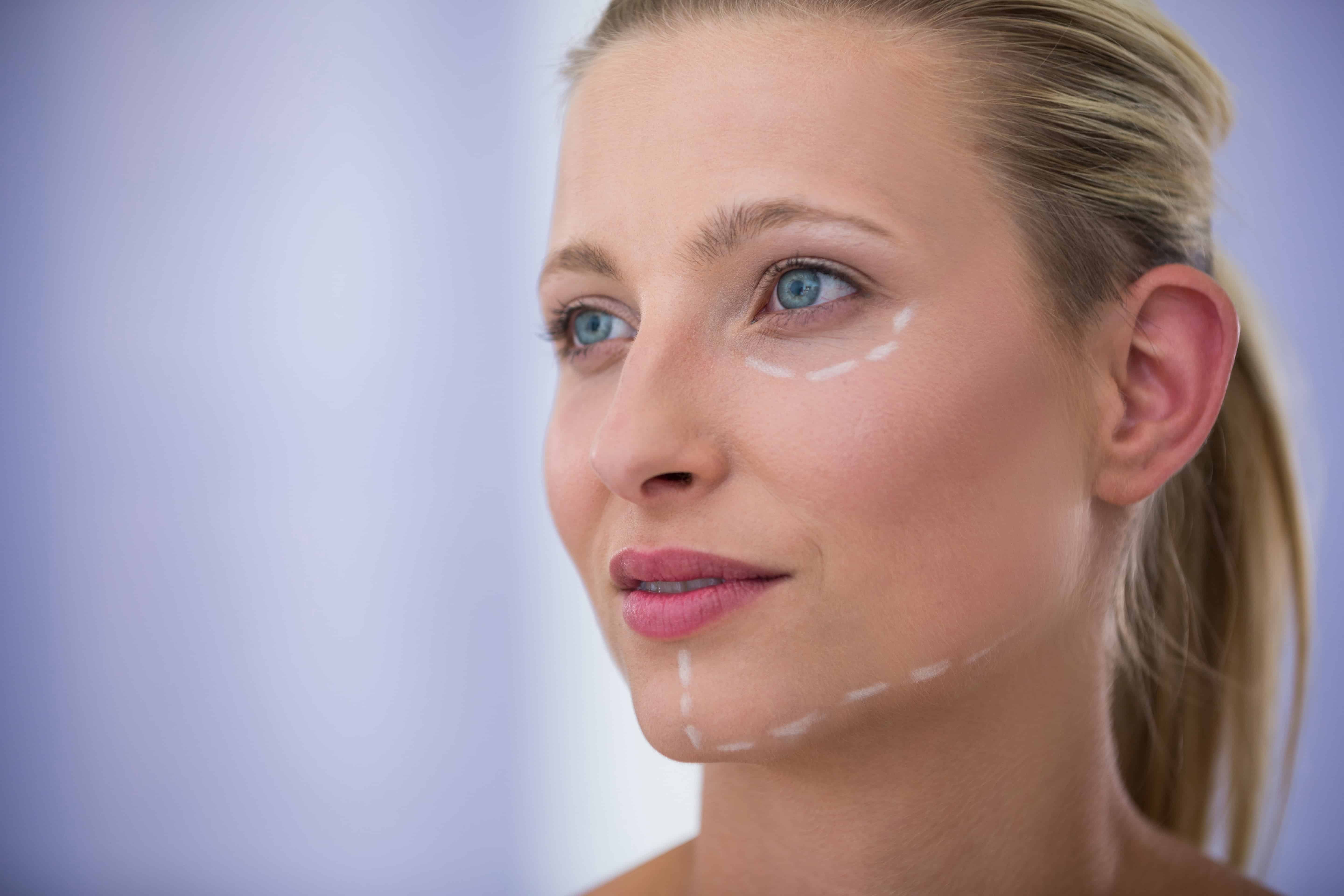 How Should You Prepare for Fractora® Treatment?