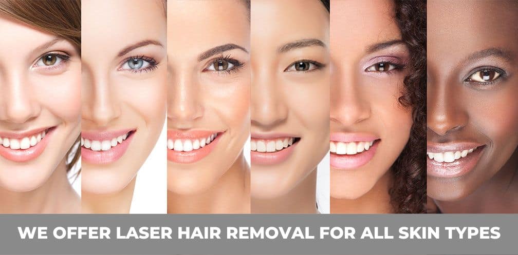 Our award-winning laser hair removal service in Kitchener-Waterloo area can treat all skin types