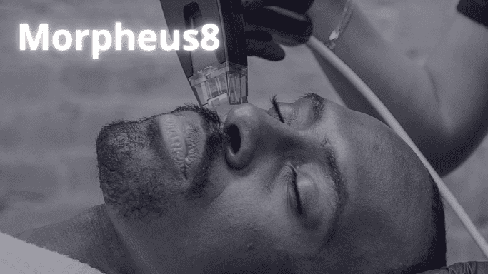 Morpheus8 treatment for me is available at our clinic