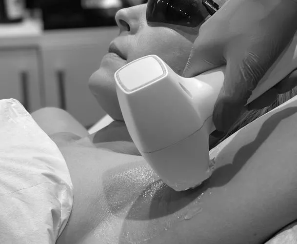 Professional laser hair removal treatment being performed on a client at a modern clinic in Kitchener