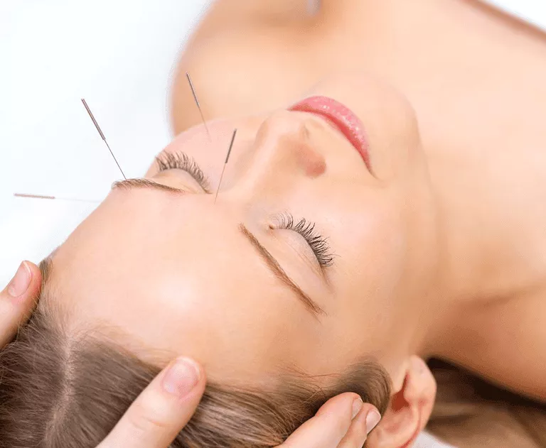 We offer acupuncture facial in Waterloo Kitchener area. Contact us for more details!