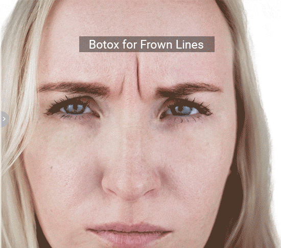 Test Page Botox (4)