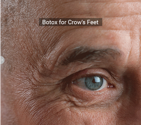 Test Page Botox (5)