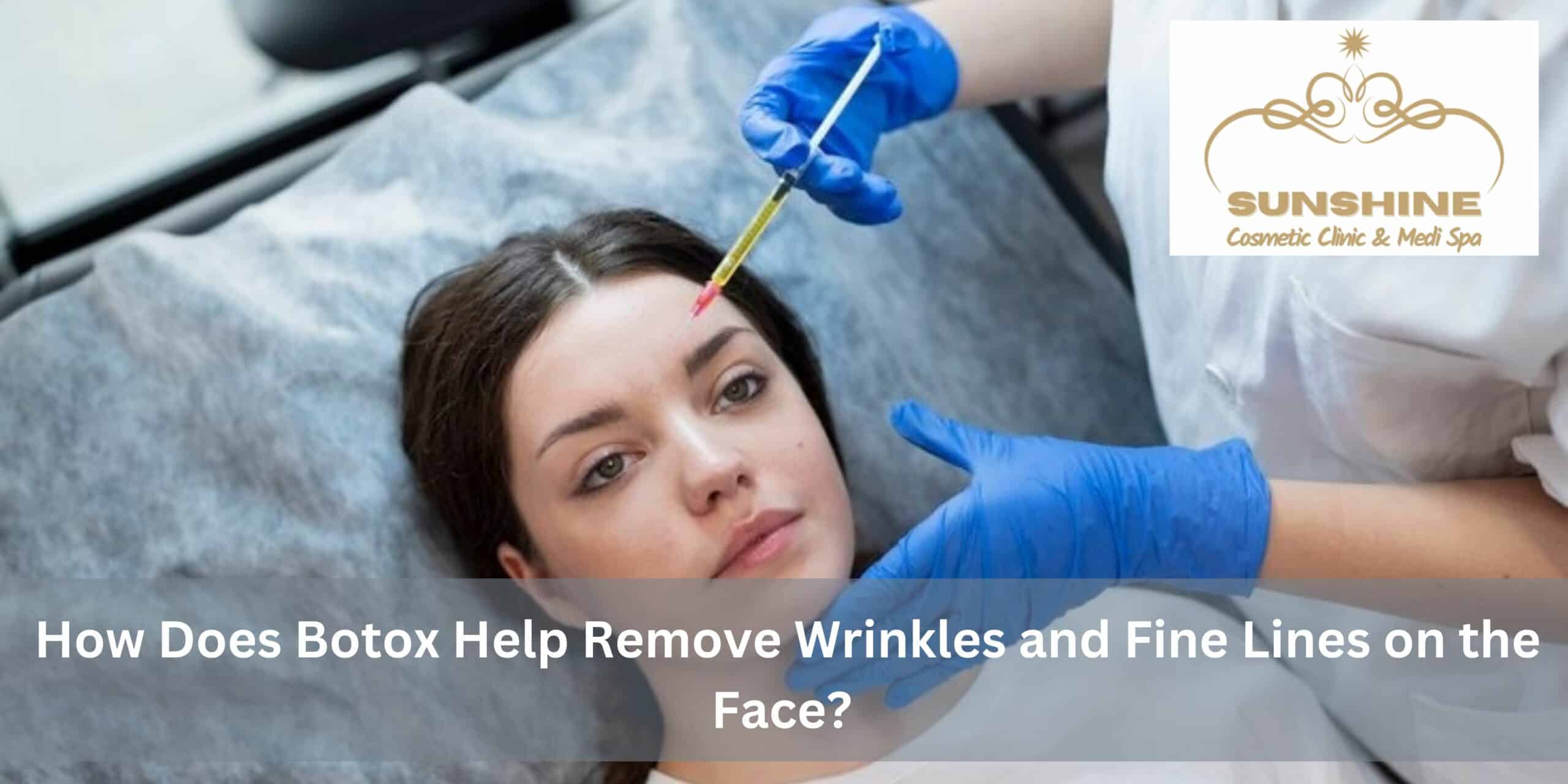 Wrinkles and Fine Lines on the Face by Sunshine Cosmetic Clinic & Medi Spa in Waterloo, ON