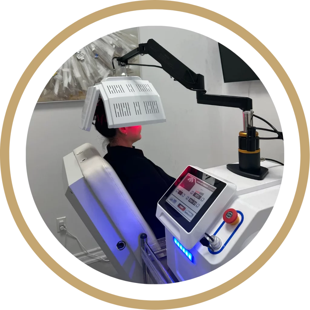 Hair Restoration | Waterloo, ON | Sunshine Cosmetic Clinic & Medi Spa