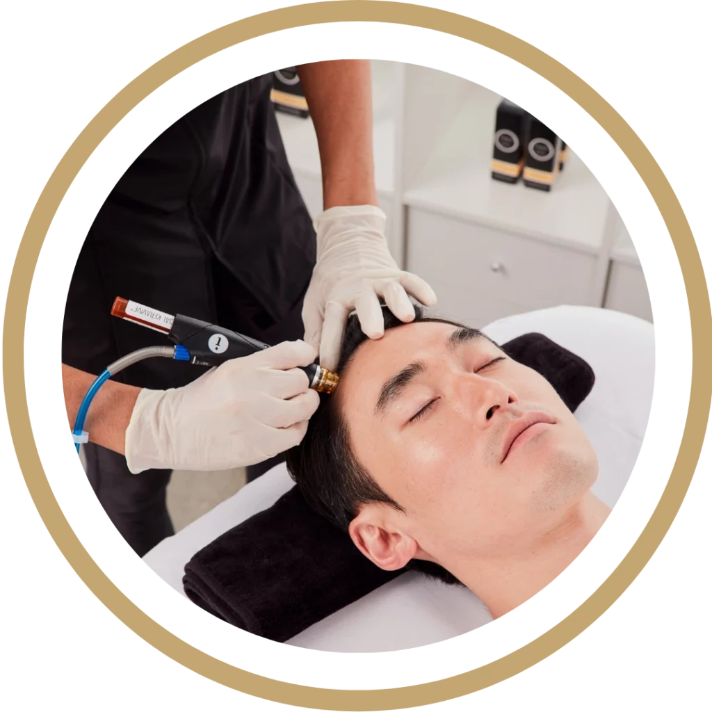 Hair Restoration | Waterloo, ON | Sunshine Cosmetic Clinic & Medi Spa