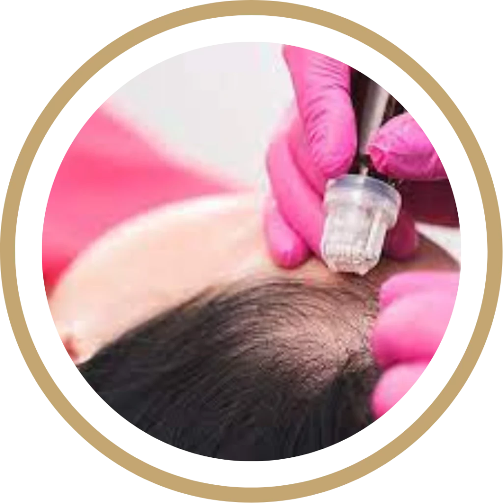 Hair Restoration | Waterloo, ON | Sunshine Cosmetic Clinic & Medi Spa