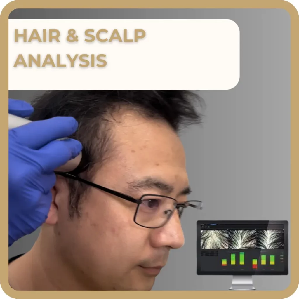 Hair Restoration | Waterloo, ON | Sunshine Cosmetic Clinic & Medi Spa