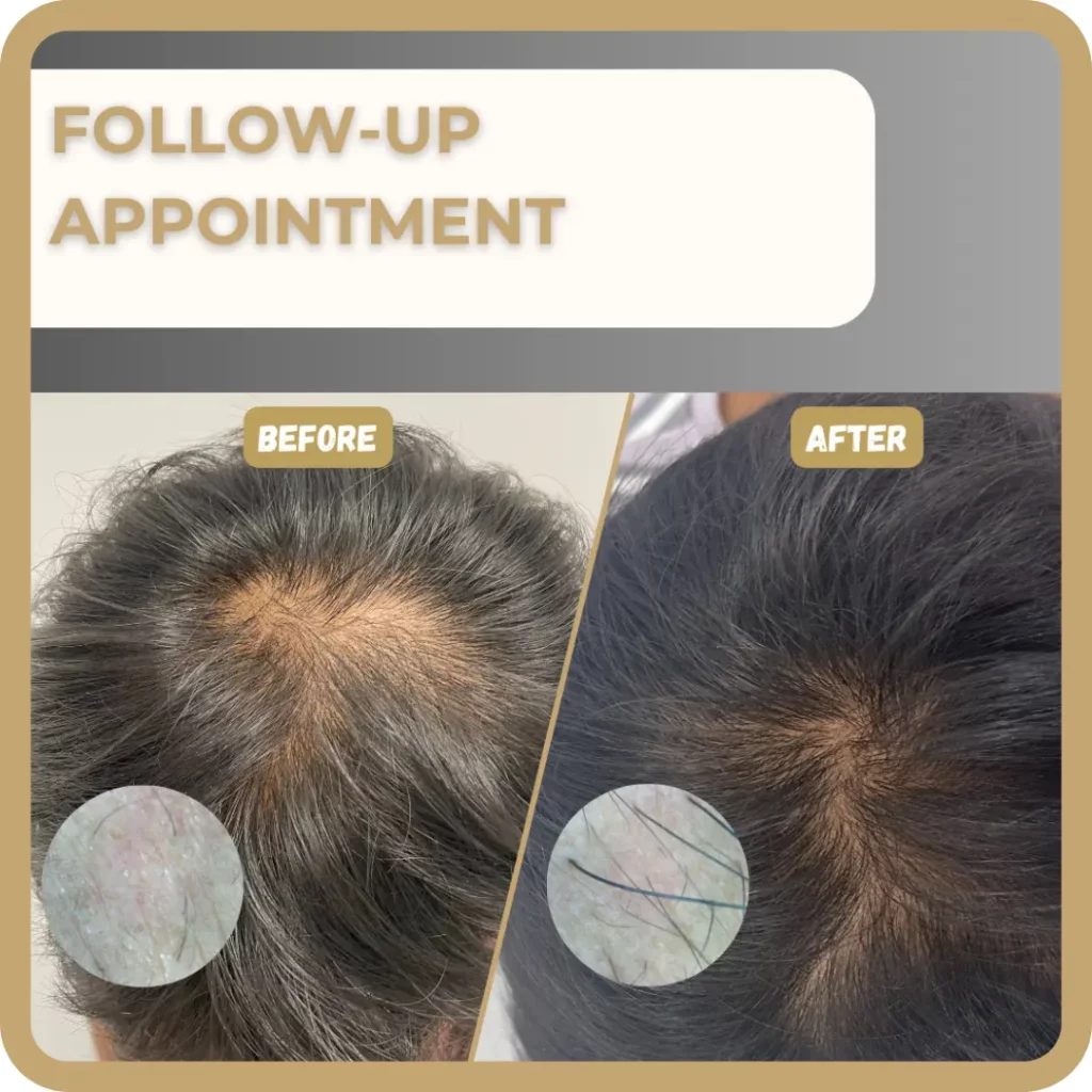 Hair Restoration | Waterloo, ON | Sunshine Cosmetic Clinic & Medi Spa