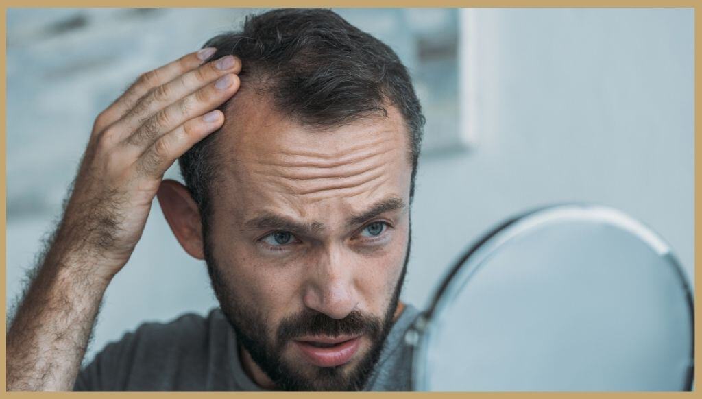 male Pattern Hair-Loss in waterloo kitchener ontario
