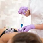 Cupping Test 113528