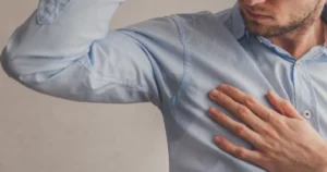 Man examining sweat stains on his shirt underarm representing Hyperhidrosis in Waterloo & Kitchener.