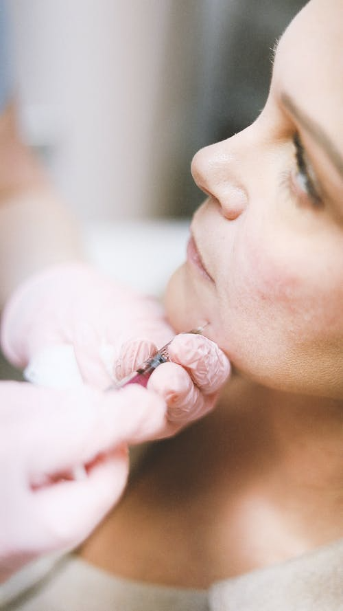 Lip Filler Waterloo – Enhance Your Lips with Natural-Looking Volume and Shape