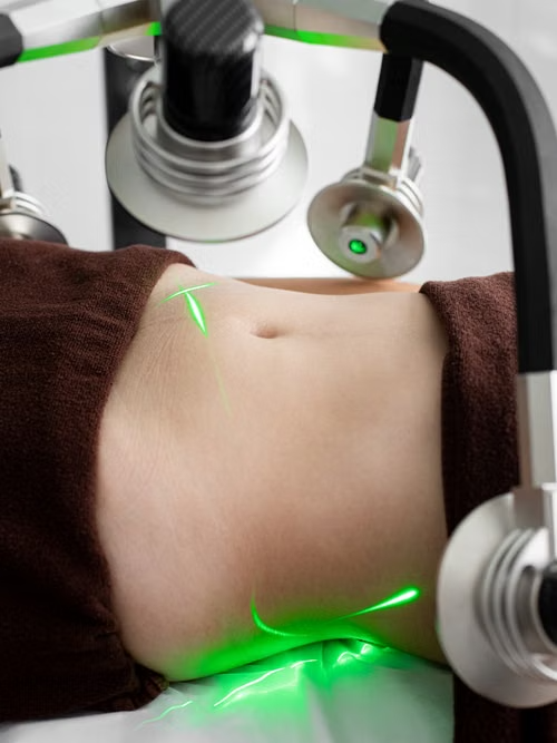 Weight Loss in Waterloo for a Personalised and Sustainable Approach | Waterloo, ON | Sunshine Cosmetic Clinic & Medi Spa